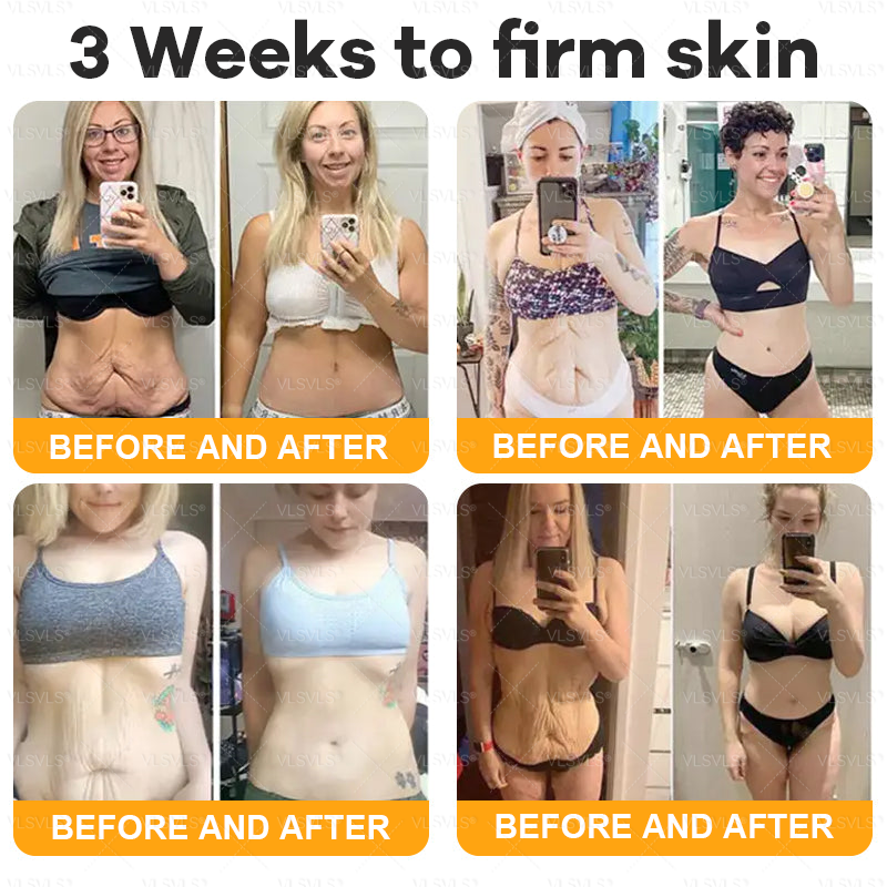 𝙑𝙇𝙎𝙑𝙇𝙎® 𝘽𝙀𝙀 𝙑𝙀𝙉𝙊𝙈 𝑺𝒌𝒊𝒏 𝑹𝒆𝒔𝒕𝒐𝒓𝒂𝒕𝒊𝒐𝒏 𝑪𝒓𝒆𝒂𝒎 –🌺 Anti-aging,Hydrating, Skin Repair, Even Tone, Acne and Dark Spot Treatment, Wart and Mole Removal, Psoriasis Relief