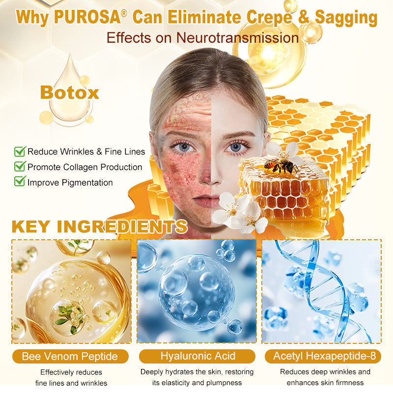 𝐕𝐋𝐒𝗩𝗟𝗦® 𝐁𝐞𝐞 𝐕𝐞𝐧𝐨𝐦 𝐒𝐤𝐢𝐧 𝐑𝐞𝐬𝐭𝐨𝐫𝐚𝐭𝐢𝐨𝐧 𝐂𝐫𝐞𝐚𝐦 👑 Anti-aging,Hydrating, Skin Repair, Even Tone, Acne and Dark Spot Treatment, Wart and Mole Removal, Psoriasis Relief 🗽