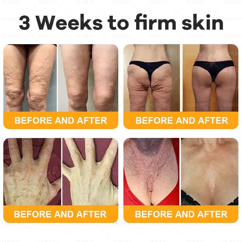 Made and Shipped from USA 🐝 𝗩𝗟𝗦𝗩𝗟𝗦® 𝑩𝒆𝒆 𝑽𝒆𝒏𝒐𝒎 𝑪𝒐𝒎𝒑𝒓𝒆𝒉𝒆𝒏𝒔𝒊𝒗𝒆 𝑪𝒓𝒆𝒂𝒎 ✅ FDA Certified