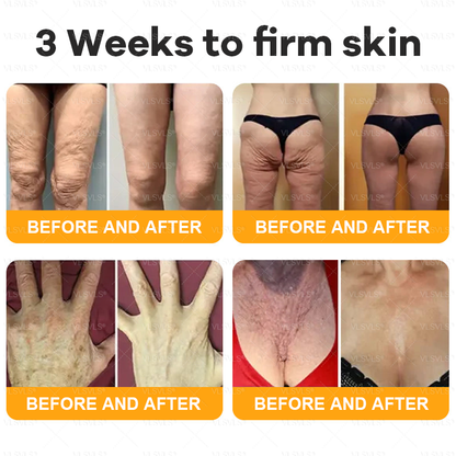 𝙑𝙇𝙎𝙑𝙇𝙎® 𝘽𝙀𝙀 𝙑𝙀𝙉𝙊𝙈 𝑺𝒌𝒊𝒏 𝑹𝒆𝒔𝒕𝒐𝒓𝒂𝒕𝒊𝒐𝒏 𝑪𝒓𝒆𝒂𝒎 –🌺 Anti-aging,Hydrating, Skin Repair, Even Tone, Acne and Dark Spot Treatment, Wart and Mole Removal, Psoriasis Relief