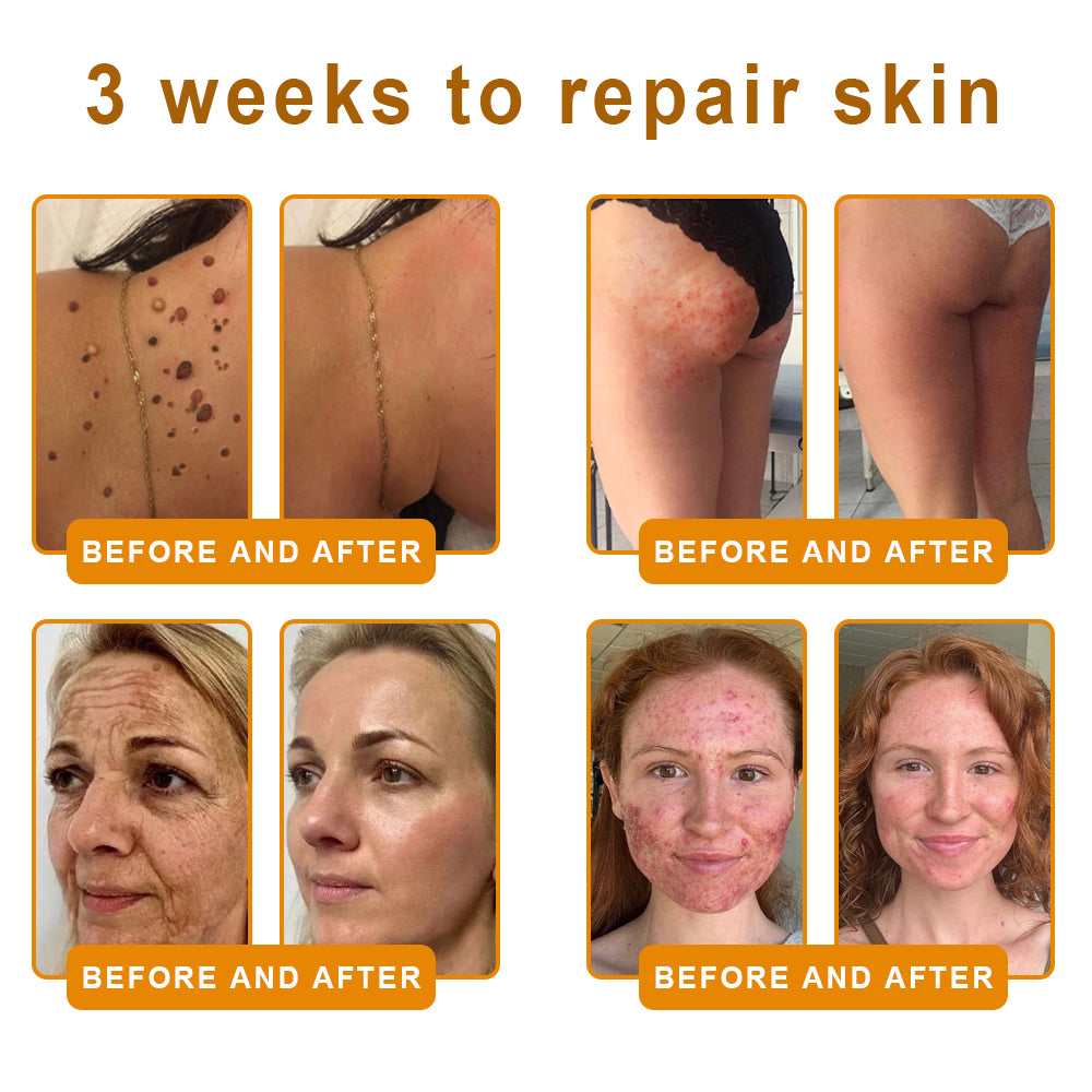 Made and Shipped from USA 🐝 𝗩𝗟𝗦𝗩𝗟𝗦® 𝑩𝒆𝒆 𝑽𝒆𝒏𝒐𝒎 𝑪𝒐𝒎𝒑𝒓𝒆𝒉𝒆𝒏𝒔𝒊𝒗𝒆 𝑪𝒓𝒆𝒂𝒎 ✅ FDA Certified