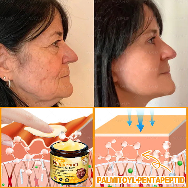 𝐕𝐋𝐒𝗩𝗟𝗦® 𝐁𝐞𝐞 𝐕𝐞𝐧𝐨𝐦 𝐒𝐤𝐢𝐧 𝐑𝐞𝐬𝐭𝐨𝐫𝐚𝐭𝐢𝐨𝐧 𝐂𝐫𝐞𝐚𝐦 👑 Anti-aging,Hydrating, Skin Repair, Even Tone, Acne and Dark Spot Treatment, Wart and Mole Removal, Psoriasis Relief 🗽